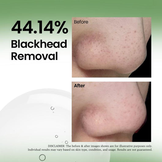 Pore Purge Kit